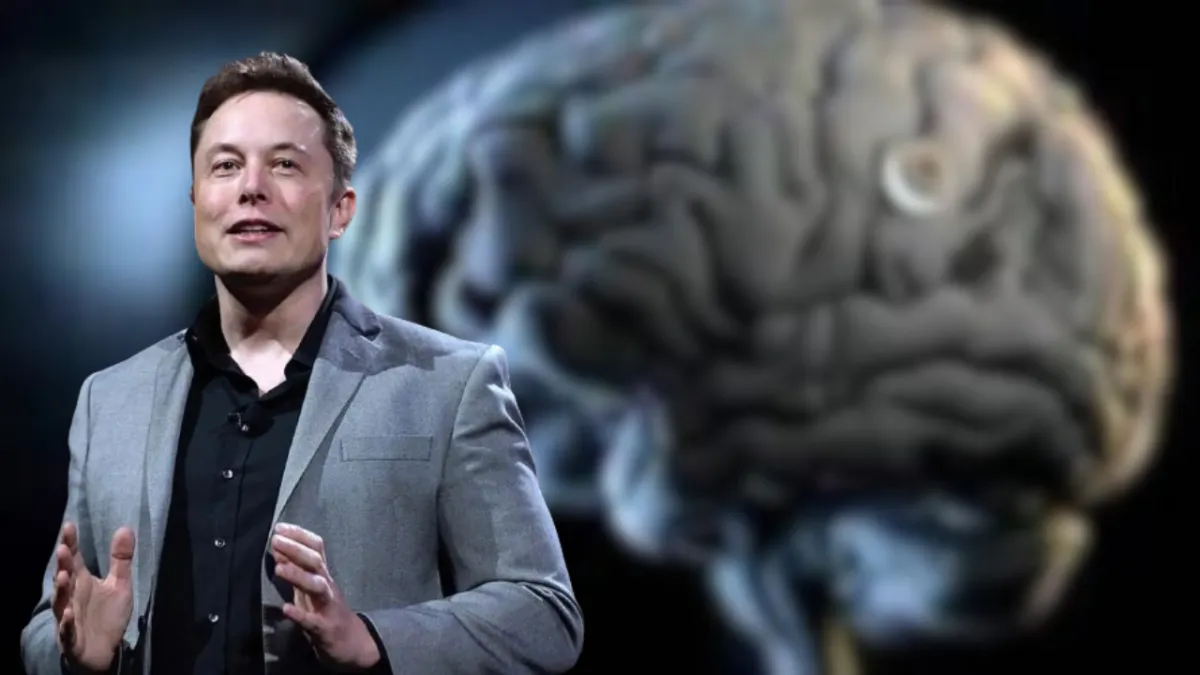 Elon Musk Umumkan Berhasil Tanam Chip ke Otak Manusia